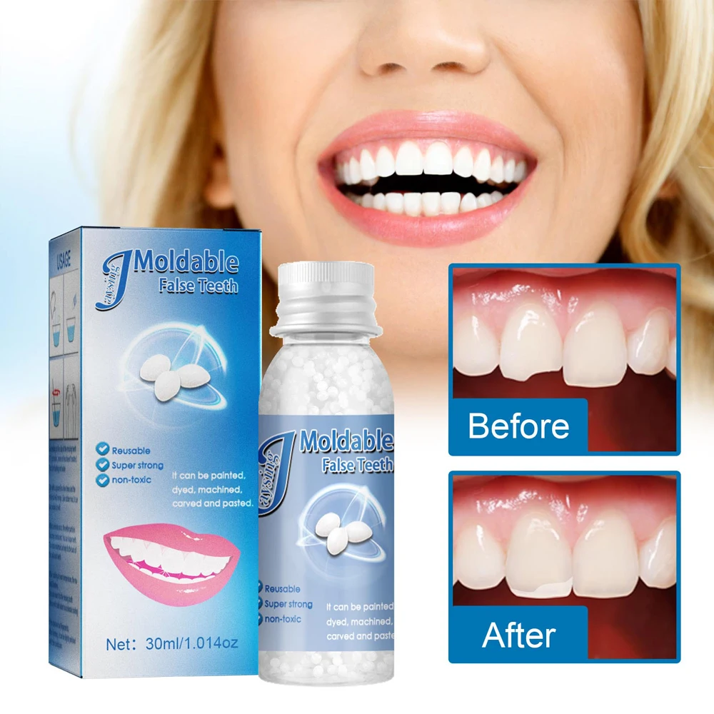 30ml Dental Resin Shapeable Teeth Glue Makeup Dentures Modification Temporary Filling Teeth Repair Broken Teeth Tooth Gaps