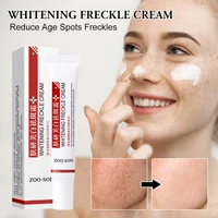 dark spot corrector cream reduce age spots freckles skin lightening blemish removal face whitening moisturizing cream