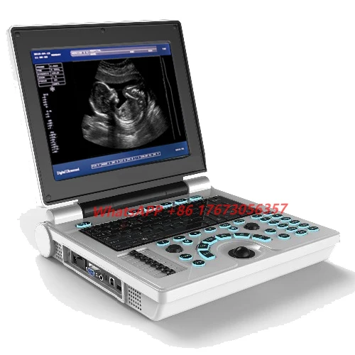 

XF30B Medical Equiptment Full Digital Best Portable Ultrasound Machine B&w In China