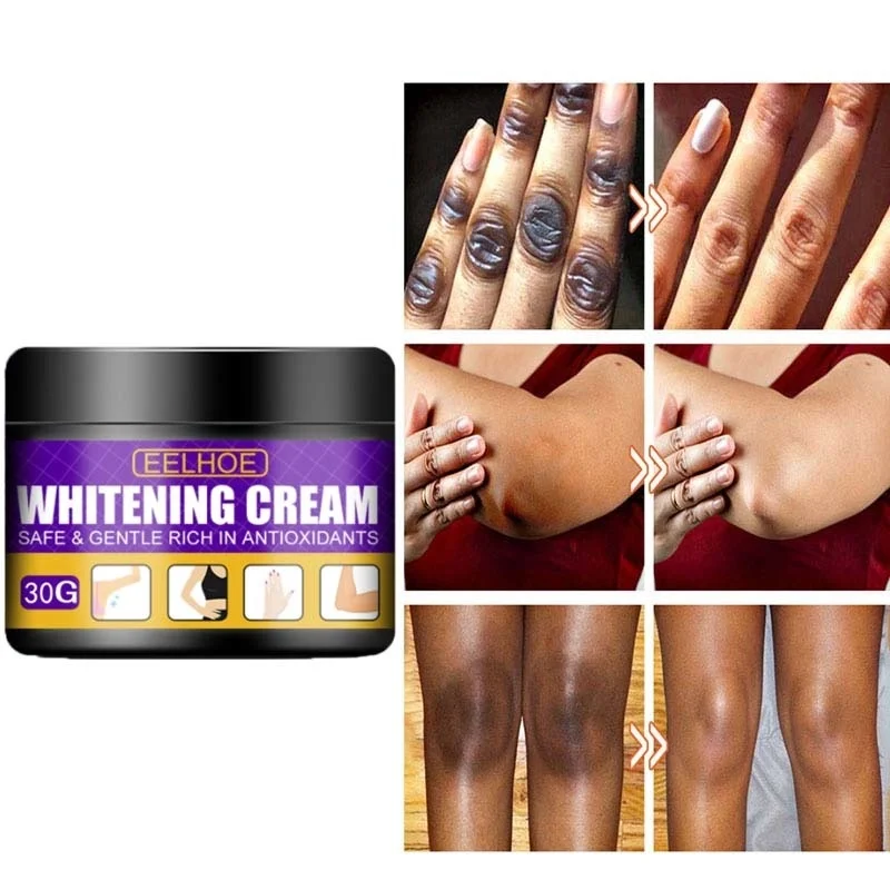 

Body Whitening Cream Improve Arm Armpit Ankles Elbow Private Parts Bleaching Serum Body Dull Melanin Brighten Beauty Skin Care