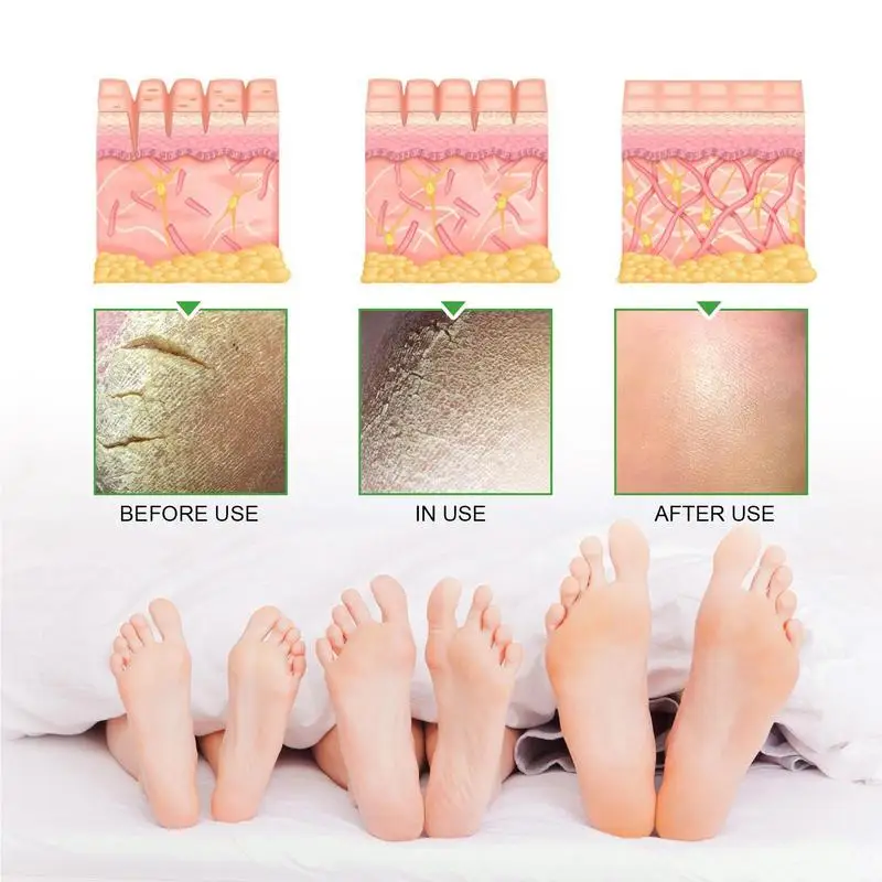 Рисунок 5 - Крем Urea 42 Plus салициловая кислота 3