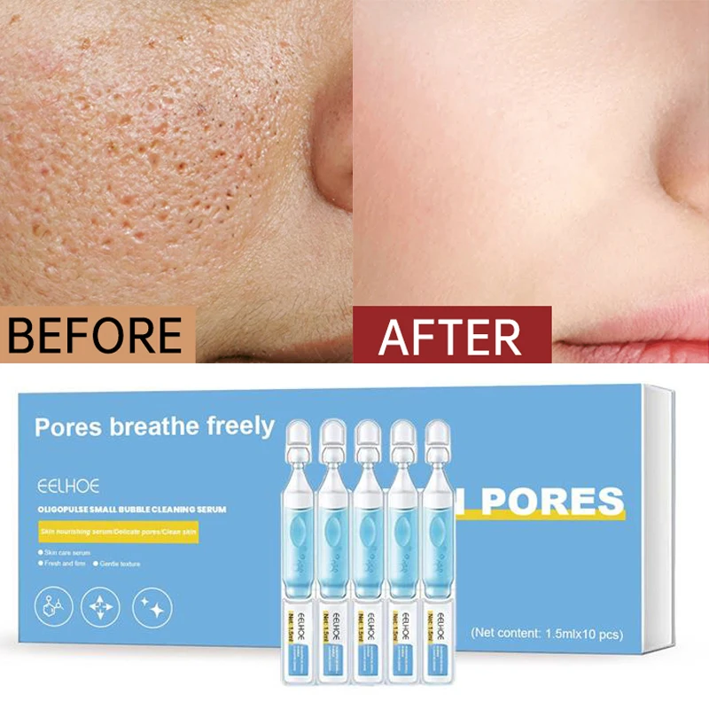 

10 PCS/Box Pore Shrinking Serum Oligopeptide Small Bubble Cleansing Essence Controlling Oil Removing Blackheads Face Skin Care