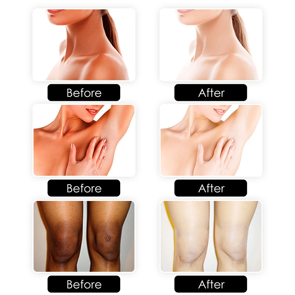 Горячая Распродажа сыворотка для лица увлажняющая против старения улучшает