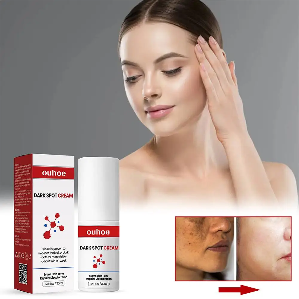 

30 мл отбеливающий крем для интимной области темная кожа Подмышечная шея внутренний локоть удаление подмышек коленей черные пятна отбеливатель V9H7