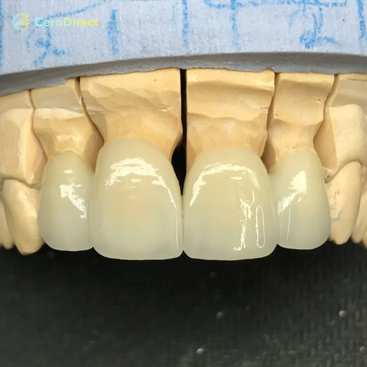 Многослойный цирконий Ceradirect 4D Pro для быстрой спекания 98*14-18 мм — стимуляции