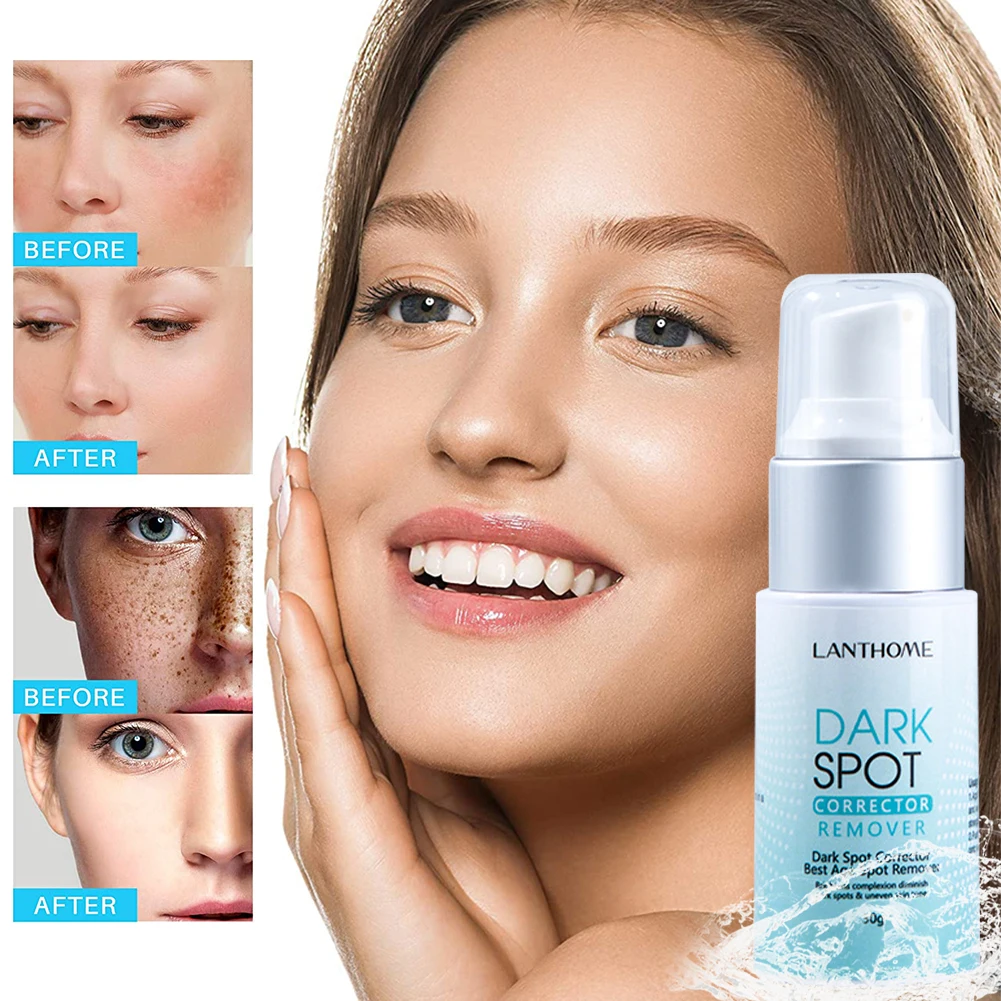 

New Dark Spot Remover Corrector Age Spot Freckle Removal Emulsion Whitening Moisturizing Anti-Aging Repair Skin Care