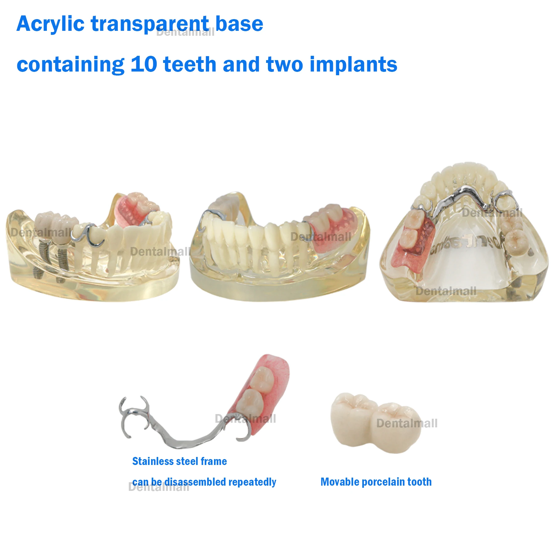 Модель зубов для восстановления имплантатов Typodont с стальным кронштейном