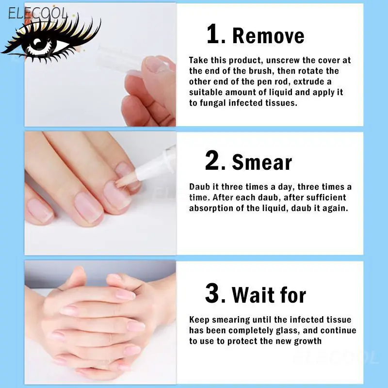 

Quick-drying Onychomycosis Easy To Use Anti-fungal Nail Remedy Cuticle Oil Convenient Pen Design