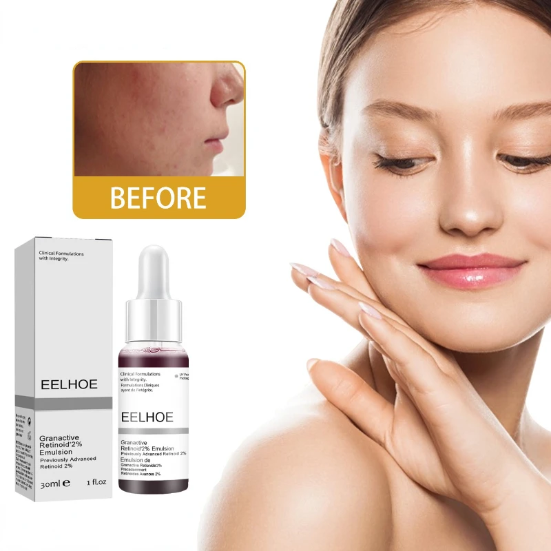 

Сыворотка для сужения пор с салициловой кислотой, фруктовая кислота, отшелушивающий увлажняющий питательный крем для гладких пор, восстана...