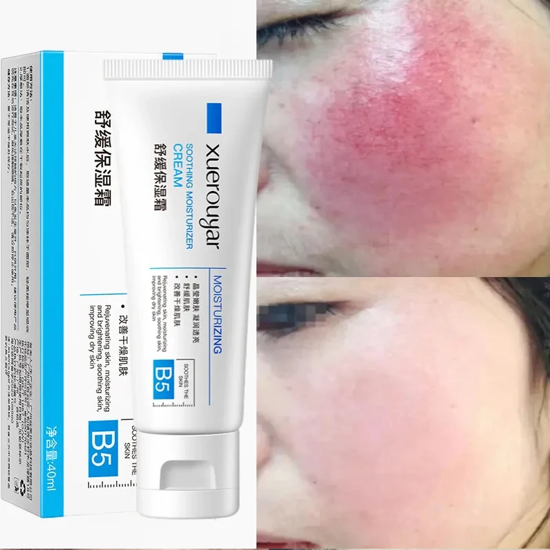 

Repair Facial Redness Cream Soothing Moisturizer Lighten Acne Mark Hydrating B5 Repair Cream Red Blood Sensitive Skin Care