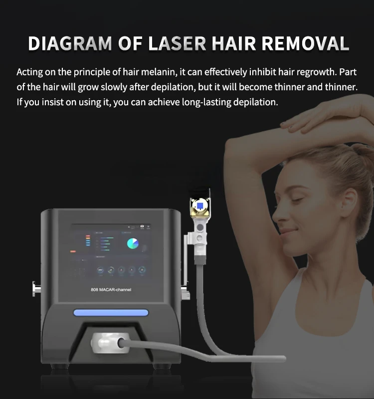 

NEW 808nm Laser Hair Removal Machine Diode Laser Hair Removal Laser Professional Professional Hair Removal skin care for Salo