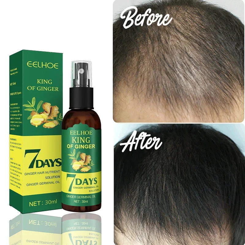 30ml Ginger Hair Growth Liquid Spray Germinal Hair Growth Essential Oil Nutrient Solution Loss Treatment Hair Care For Men Women
