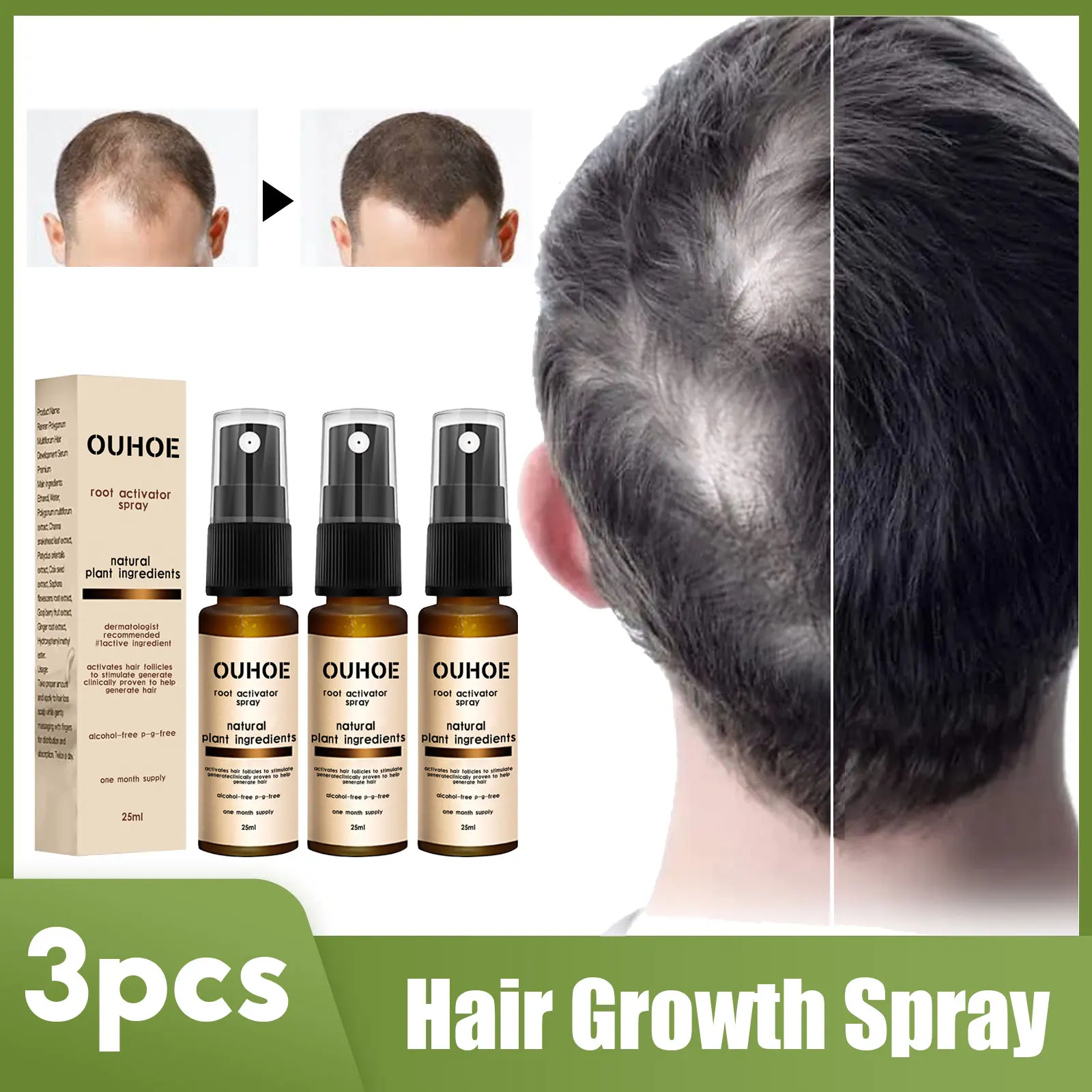 

3PCS Hair Growth Serum Spray Fast Regrowth Repair Dry Damaged Root Hair Essence Deep Nourishing Anti Hair Loss Scalp Treatment
