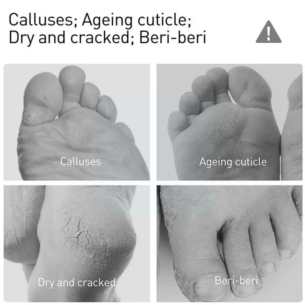 

Косметический пилинг для ног, спрей, натуральная Апельсиновая эссенция, Отбеливающее средство для ухода за ребенком, инструмент для педикю...