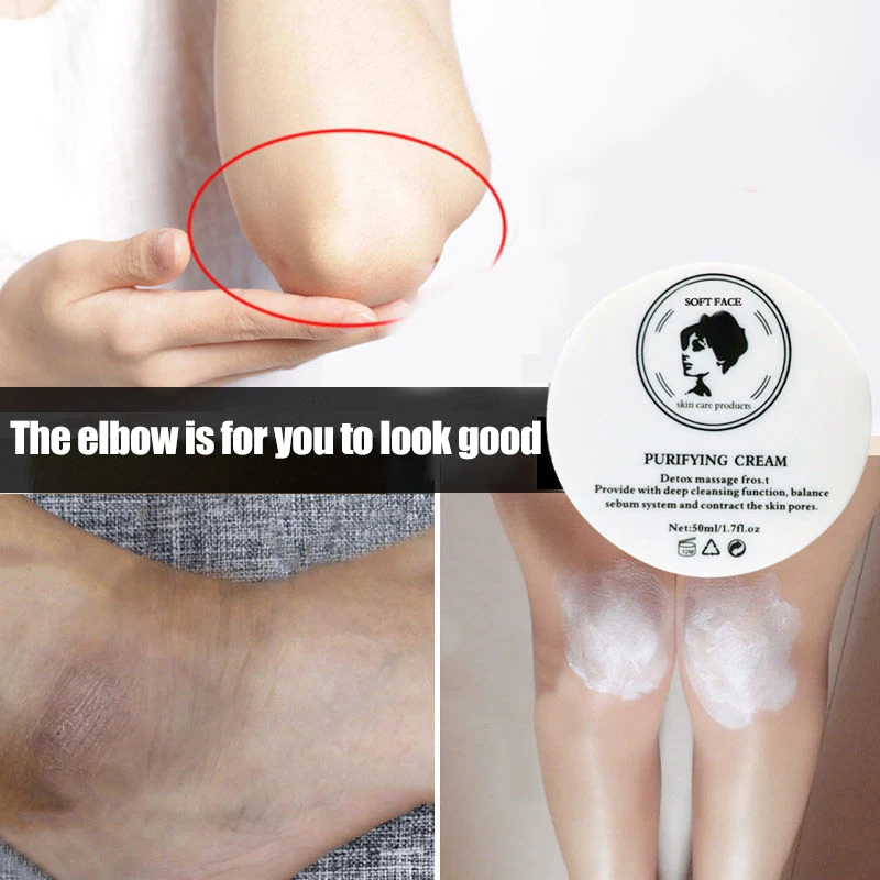

Remove Melanin Pigmentation Fast Whitening Cream For Private Parts Knuckle Elbows Stains Remover Serum Anti Acanthosis Nigrican
