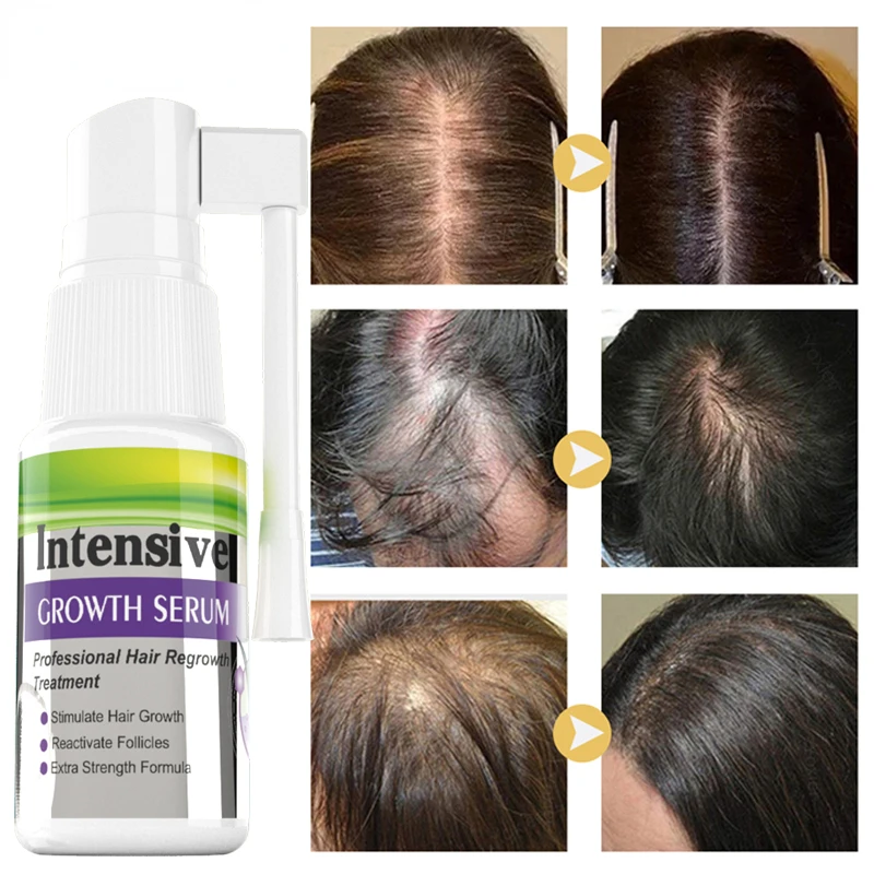 

Жидкость для выпадения волос с имбирем, 20 мл, способствует восстановлению роста волос, предотвращает повреждение и облысение, уход за волос...