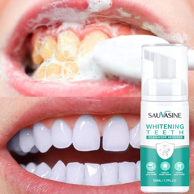 

Teeth Whitening Mousse Toothpaste Dental Bleach Cleaning Tools Oral Hygiene Fresh Breath Removes Stains Whitener Care Products