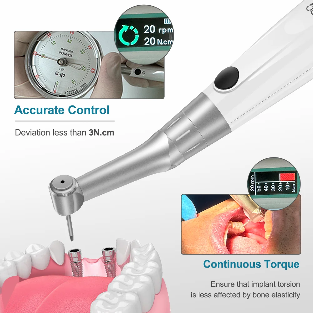 AI-TW-MT7 Беспроводной стоматологический динамометрический ключ для имплантатов