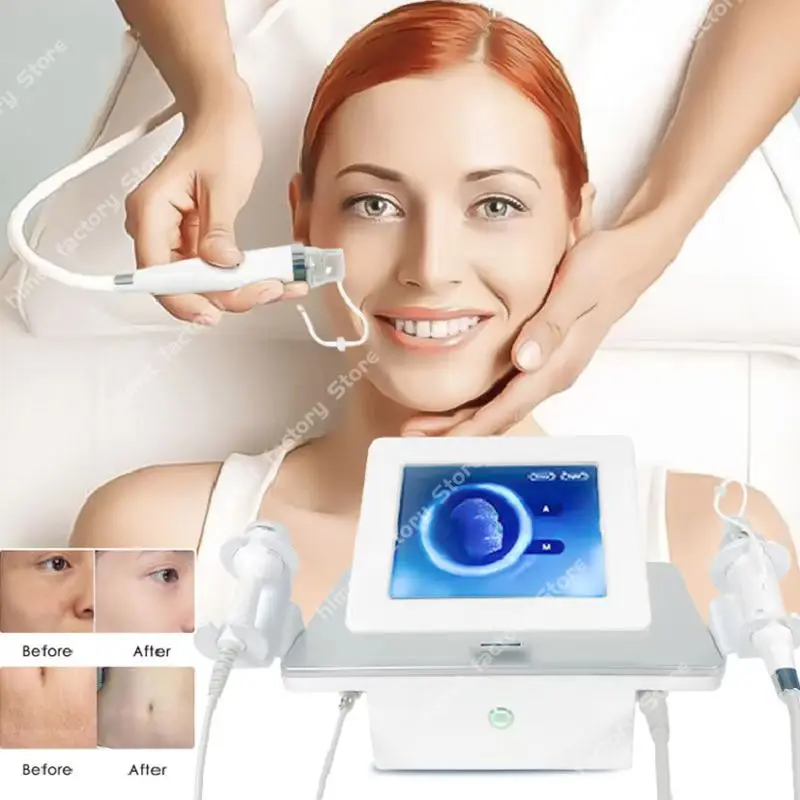 

2020 Dalusha secret R/F фракционная микроигла R/F Машина Для Удаления растяжек от акне