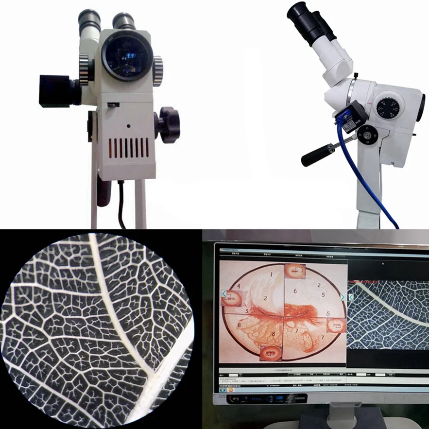 CE 510K KERNEL KN-2200BI Бинокулярное оптическое видео для гинекологии