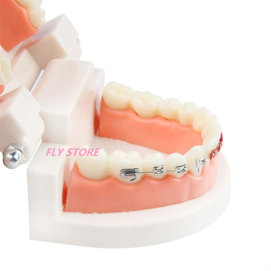 

Dental Orthodontic Treatment Model With Ortho Metal Ceramic Bracket Arch Wire Buccal Tube Ligature Ties Dental Tools Dentist Lab