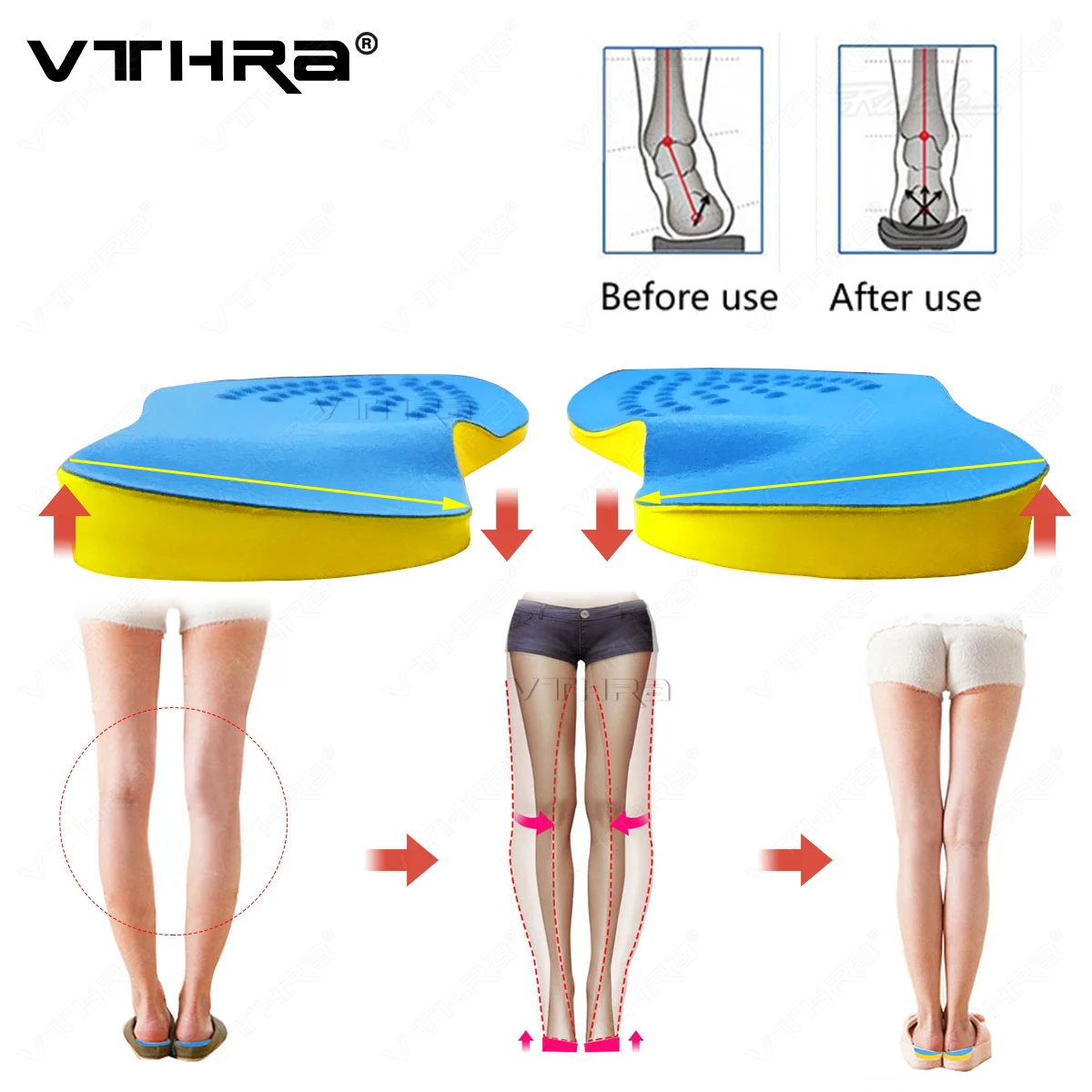 

VTHRA O/X Leg Orthopedic Insoles Correction Shoes Inserts For Foot Alignment Knock Knee Pain Bow Valgus Varus Feet Care Cushions