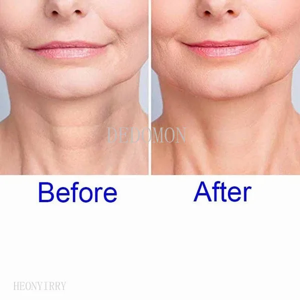 Силиконовая накладка против морщин наклейка для ухода за кожей лица лба шеи