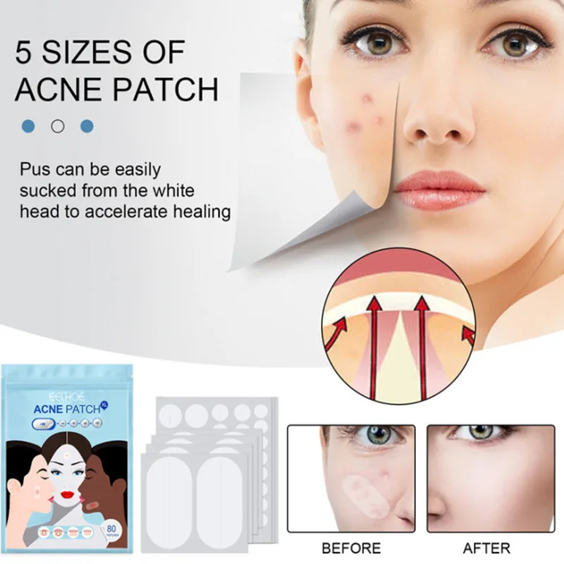 

80 Pcs Invisible Cleansing Acne Sticker To Acne Sealing Acne Waterproof Concealer Hydrocolloid Oil Acne Sticker Skin Care