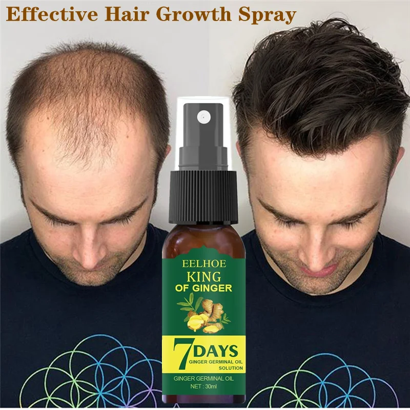 

30 мл эссенция для роста волос Germinal сывороточная эссенция масло натуральные выпадение волос лечение для мужчин t эффективное быстрое выращи...