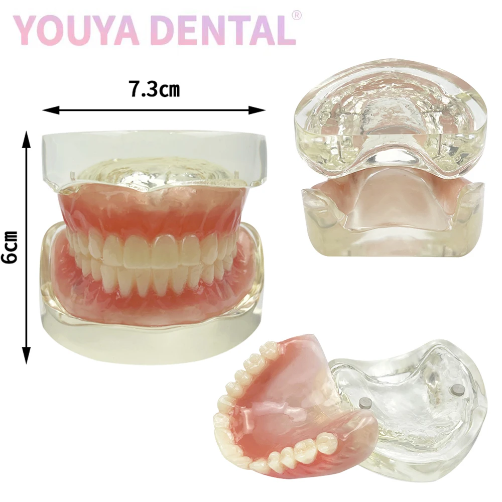 1 комплект съемный адсорбционный зуб для зубного имплантата верхняя нижняя часть