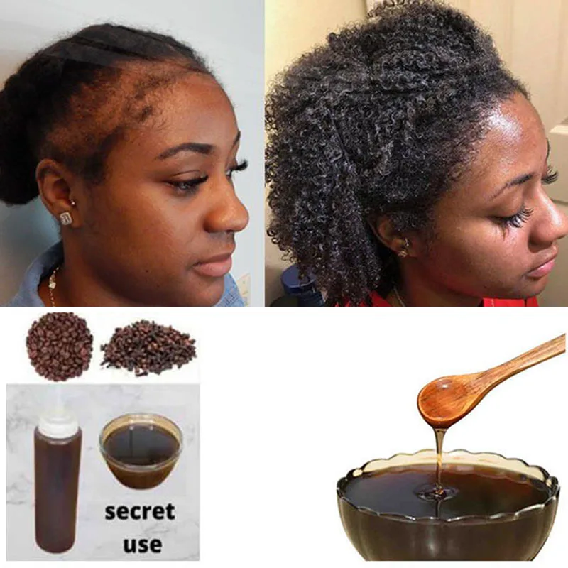 100ml Traction Alopecia Africa Chebe Powder Local Ingredients with Modern Craftsmanship 2 Month Super Fast Hair Growth Shampoo