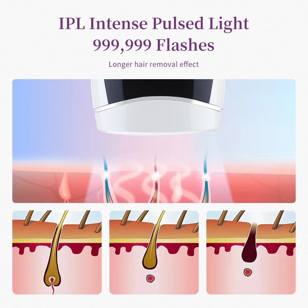 IPL Laser Epilator 990000 Flashes Laser Hair Removal Apparatus Photon Rejuvenation Apparatus Home Painless Hair Removal Device enlarge