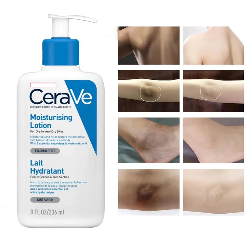 

CeraVe Whitening Cream Moisturizing Nourish Repair Improve Arm Armpit Ankles Elbow Knee Body Dull Brighten Arbutin Skin Care 236
