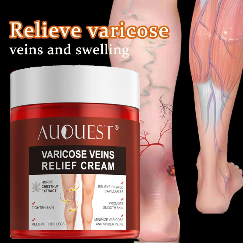 Varicose Veins Treatment Cream Relieve Leg Tired Vasculitis Phlebitis Spider Pain Ointment Plaster Muscle Swelling Elimination