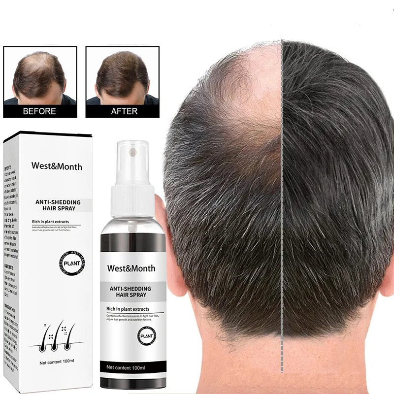

Powerful Hair Growth Serum Spray Anti Hairs Loss Product Treatment Essence Oil Repair Nourish Roots Regrowth For Men Women 100ml