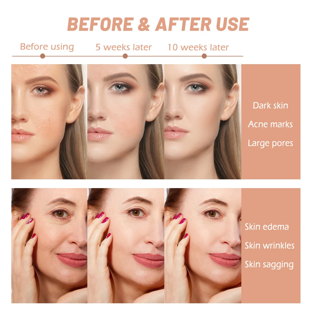 Аппарат для терапии со светодиодсветильник кой 7 цветов | Красота и здоровье