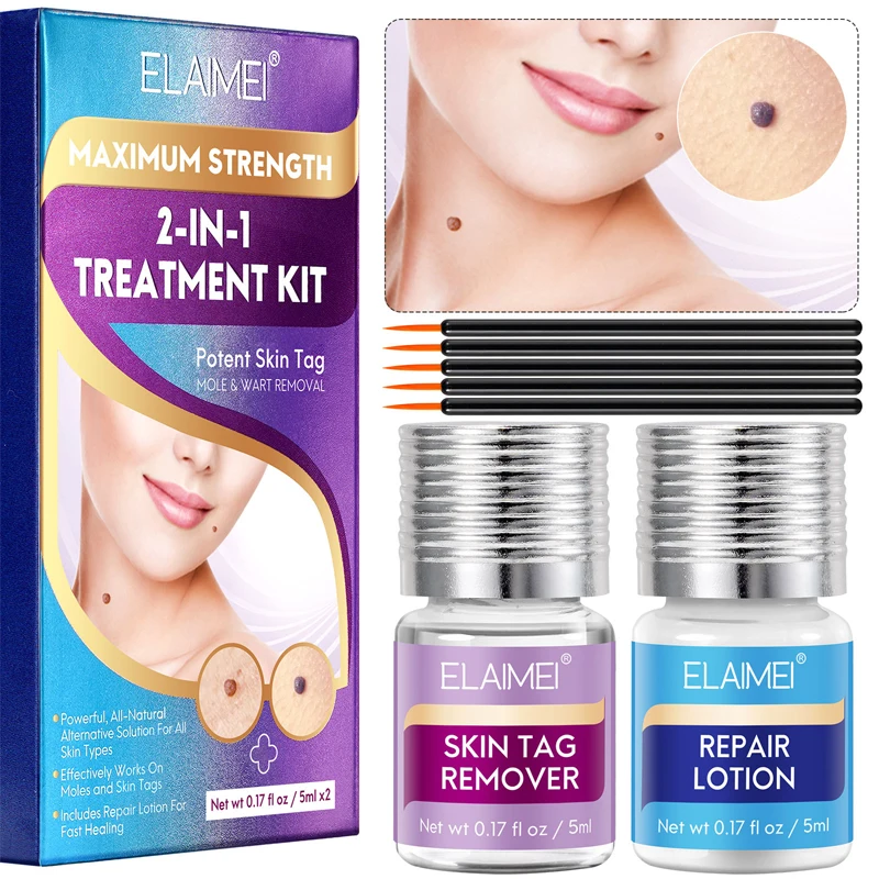 Nevus Warts Remover Set Against Moles Painless Warts Skin Tag Papillomas Foot Corn Body Face Flat Wart Fast Removal Serum Oil