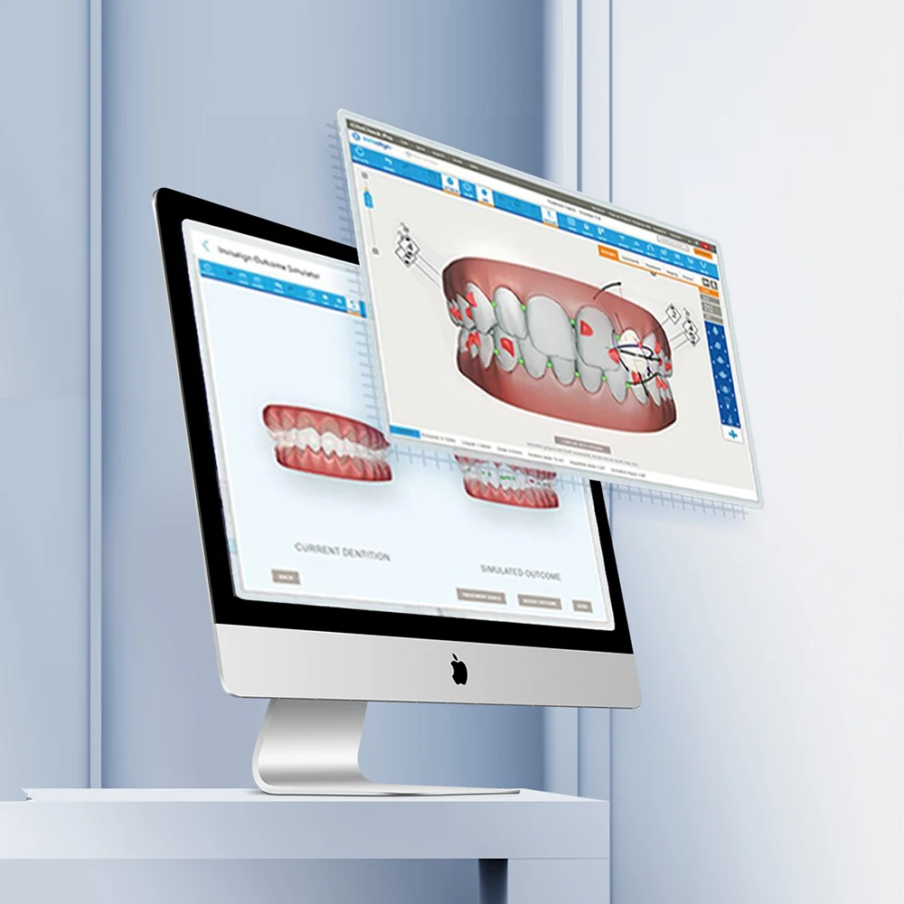 Стоматологический сканер AZDENT внутриротовой 3D-сканер с программным обеспечением