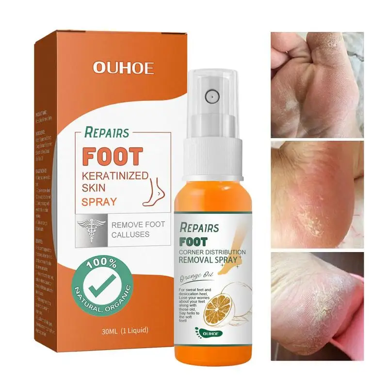 

Foot Peel Spray Instant Foot Peeling Spray That Removes Dead Skin Pedicure Dead Skin Exfoliator For Making Soft Smooth Feet