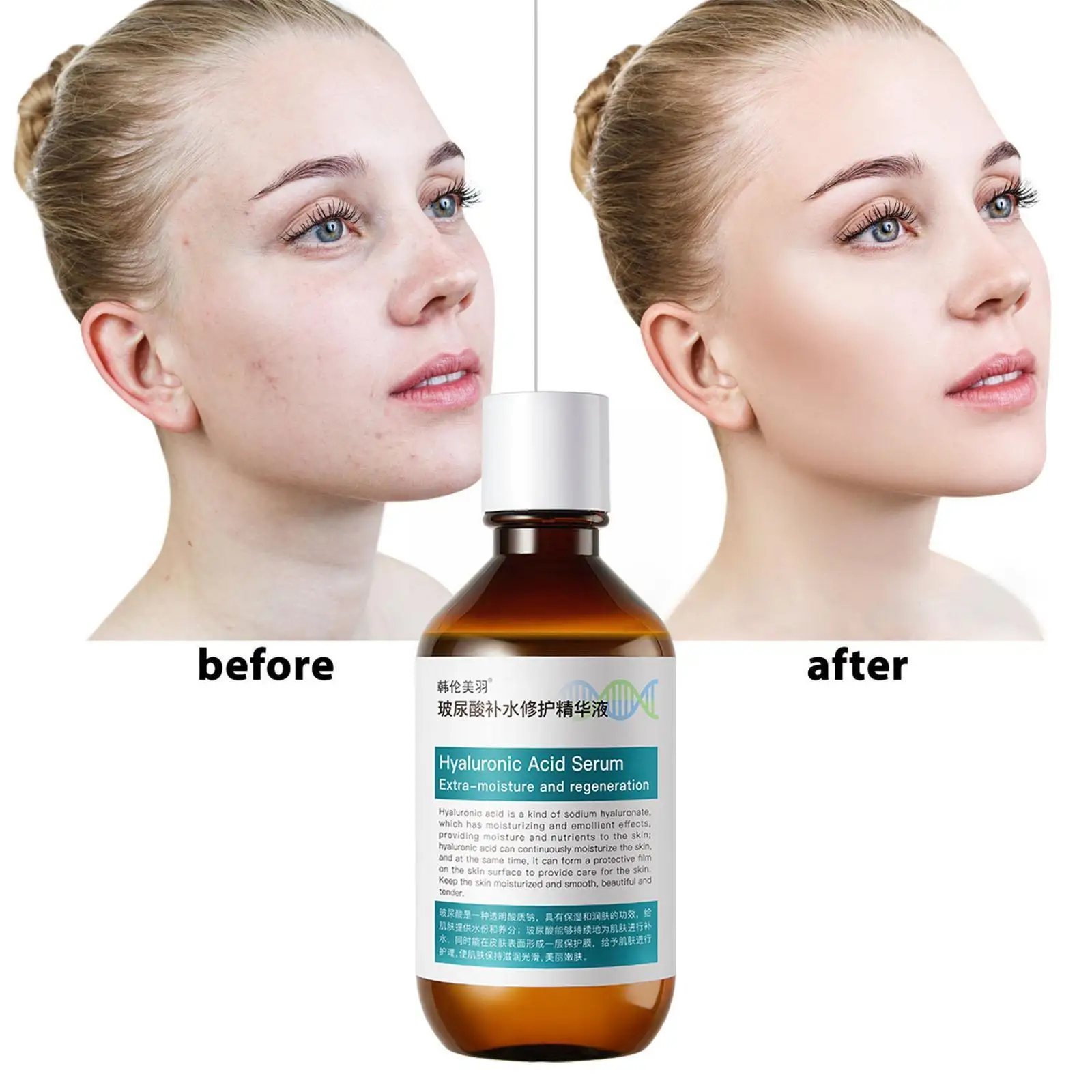 

Ампула с гиалуроновой кислотой, Освежающая, увлажняющая, Антивозрастная, с оригинальными линиями, восстанавливает тонкую большую кожу Li F5O1