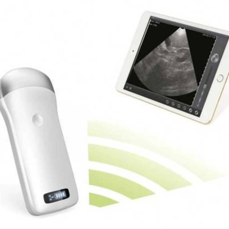 the smallest ultrasound scanner usb ultrasound linear probe