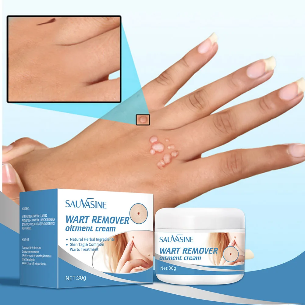 

Painless Wart Remover Cream Treatment of The Skin of The Neck Armpits Genitals and Flat Warts Calluses of The Feet Ointment