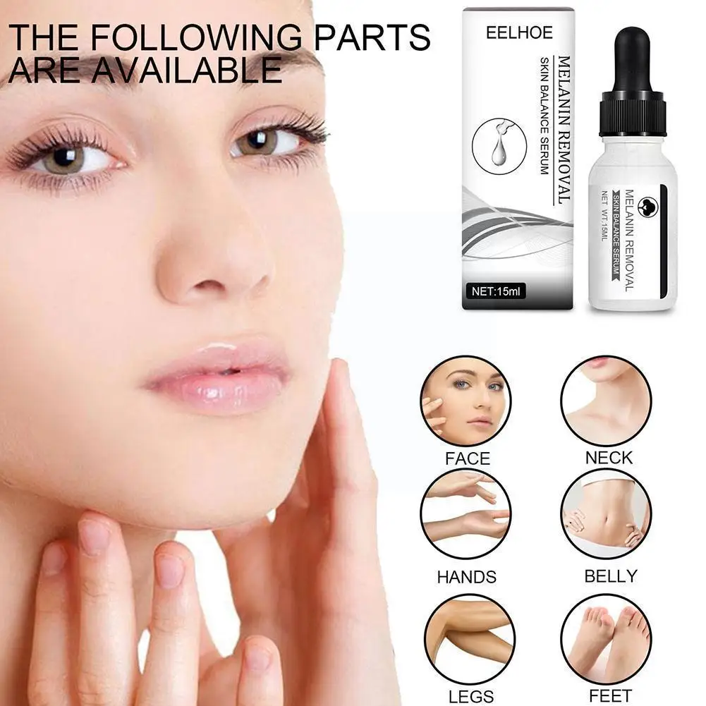 

Whitening Freckle Essence Whitening Lightening Blemish Liquid Melasma Pigmentation Fade Remove Freckle Dark Anti Essence Sp S2c7