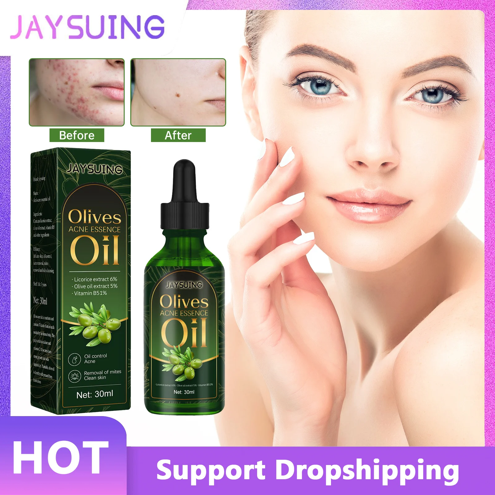 

Acne Treatment Serum Oil Olive Anti Acne Repairing Pores Shrink Remove Marks Moisturizing Oil Control Eliminate Pimples Essence