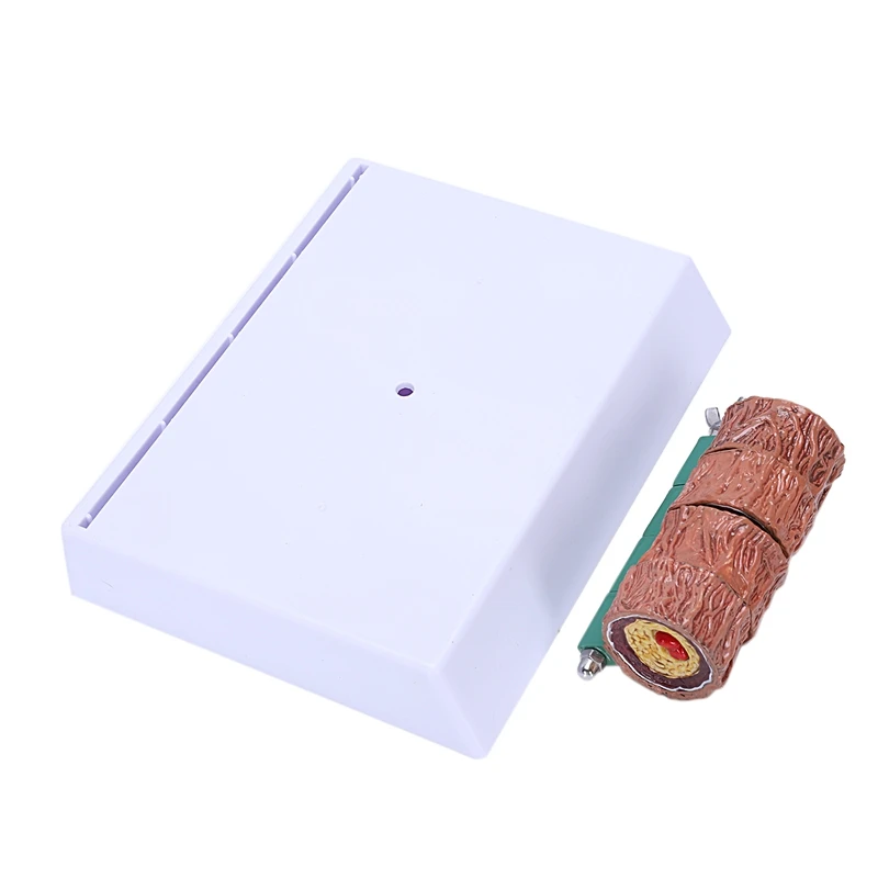 Модель тромбоза атеросклероза демонстрация сосудистых заболеваний модель