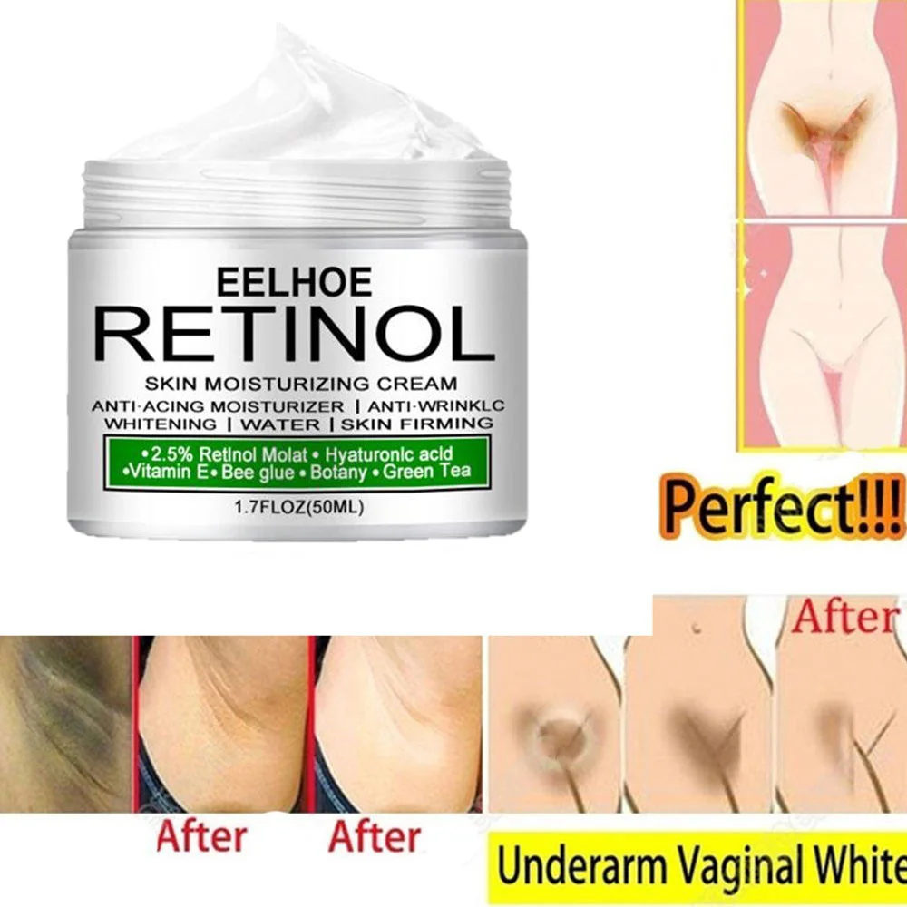 Body Whitening Cream Underarm Knee Buttocks Private Bleach Remove Melanin Pigmentation Improve Dull Nourish Brighten Skin Care