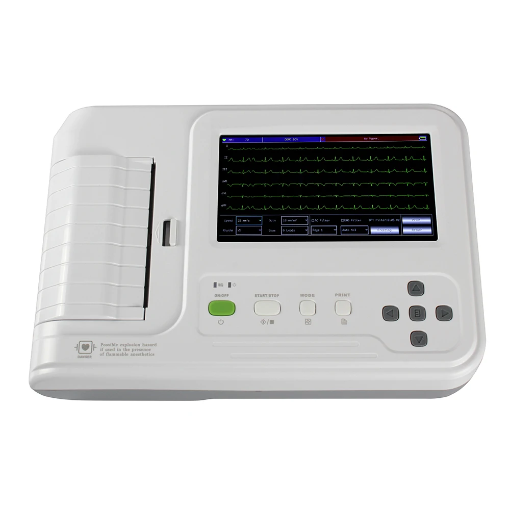 

Цифровой Электрокардиограф CONTEC ECG600G, 6 каналов, 12 выводов, монитор ЭКГ с термопринтером