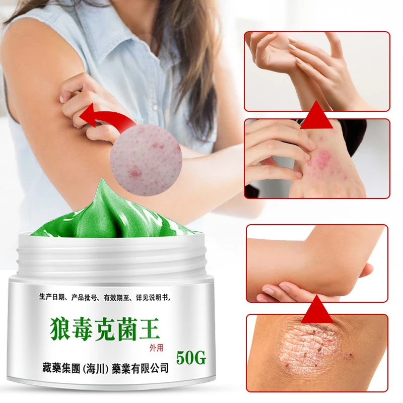 

50g Psoriasis Dermatitis Eczematoid Eczema Ointment Anti-Itch Chinese Herb Medical Skin Care Cream