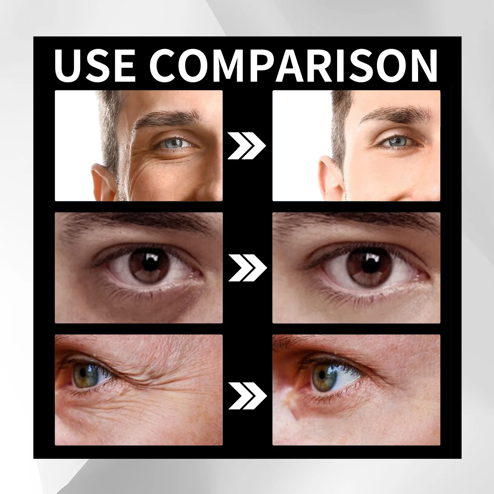 Рисунок 6 - Ролик для области вокруг глаз от