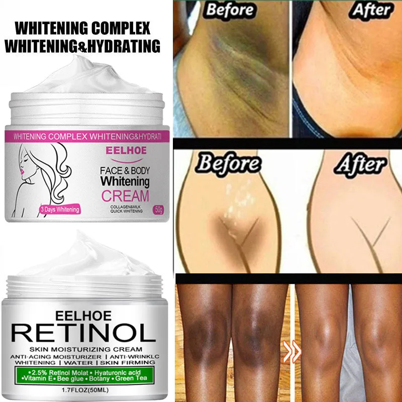 

50ml Body Whitening Cream Armpit Private Part Bleaching Remove Melanin Pigmentation Brighten Inner Thigh Sexy Women Body Lotion